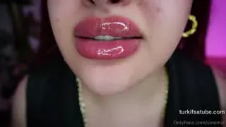 15387806